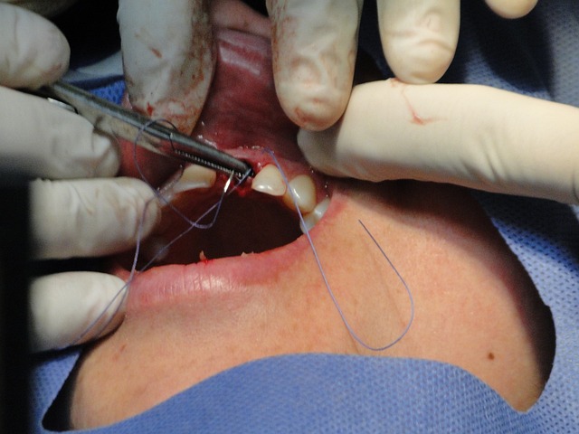 operace zubu